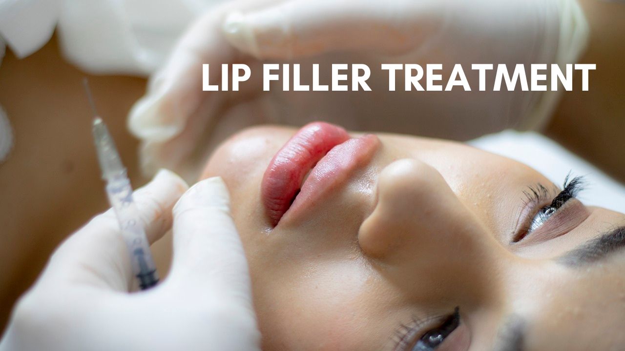 Lip fillers in Delhi