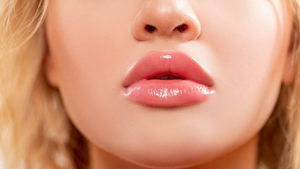 results of lip fillers 