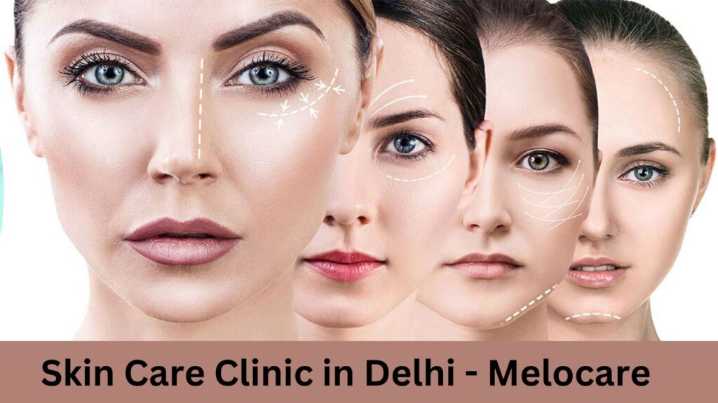 Skin Care Clinic in Delhi