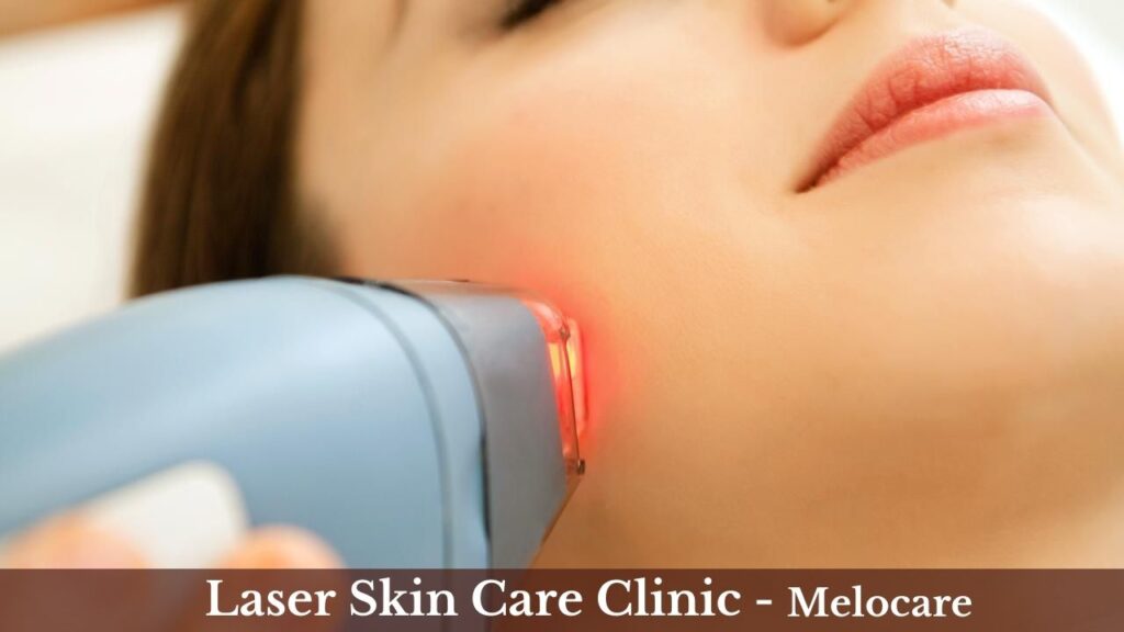 Best Laser Skin Care Clinic in Delhi | Melocare