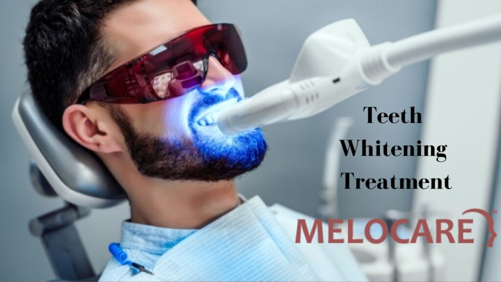 Teeth Whitening Treatment - Melocare