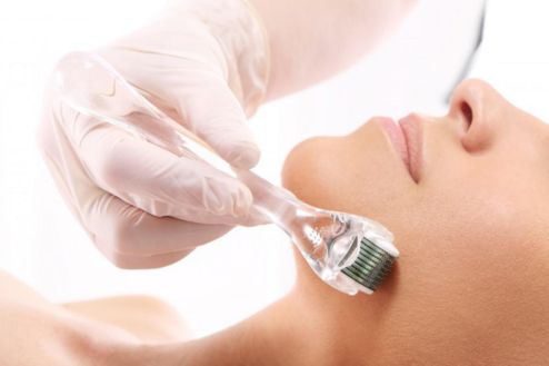 Microneedling Therapy