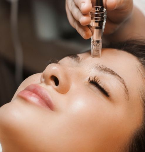 Microneedling Therapy