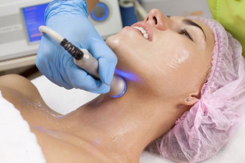 Radiofrequency Clean Up Facial