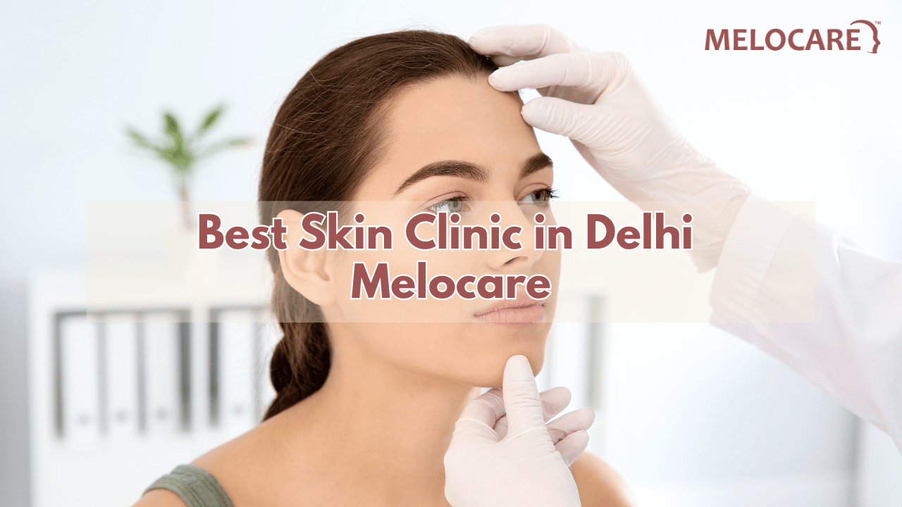 Skin Clinic in Delhi