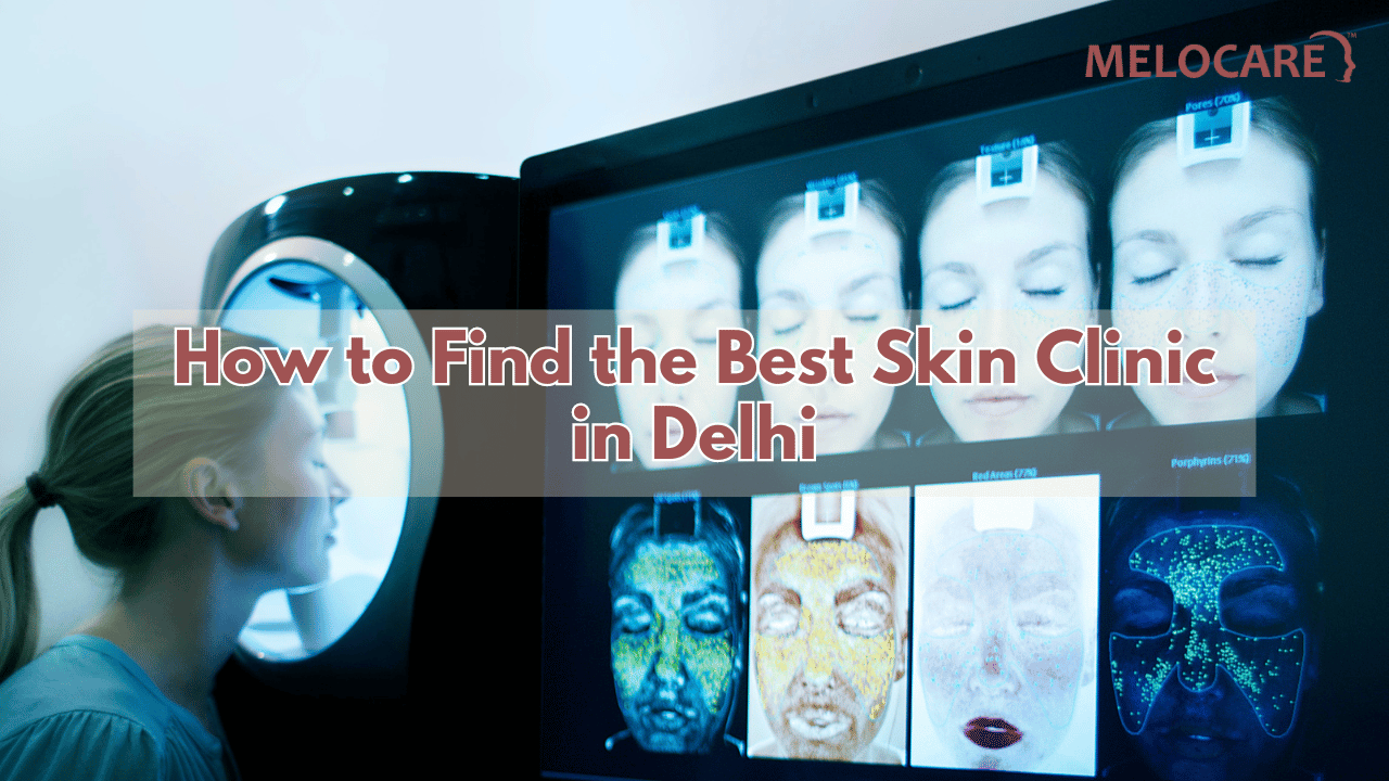 Skin Clinic in Delhi