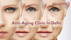 Melocare is the best Anti-Aging Clinic In Delhi