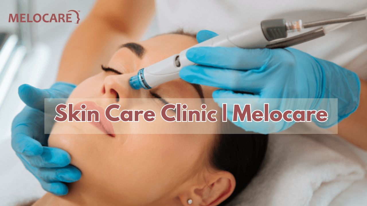 Melocare Skin Clinic in Delhi