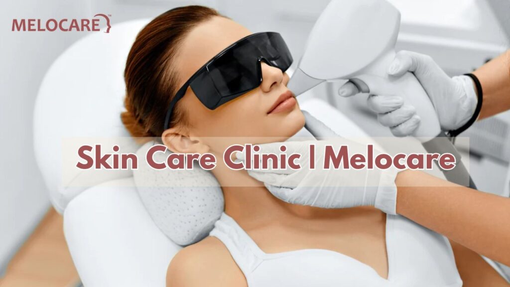 Achieve Radiant Skin with Melocare Skin Clinic in Delhi