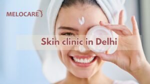 Skin clinic in Delhi