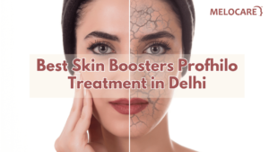 Skin Boosters Profhilo Treatment