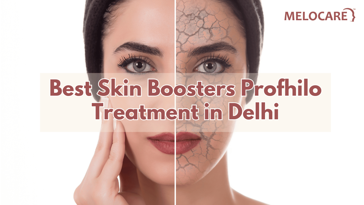 Skin Boosters Profhilo Treatment