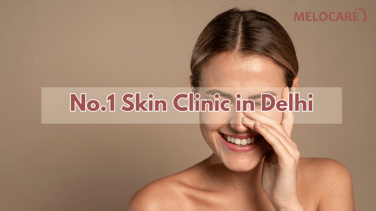 Skin Clinic in Delhi