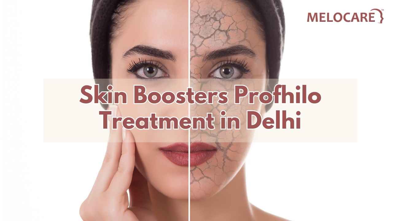 Skin Boosters Profhilo Treatment