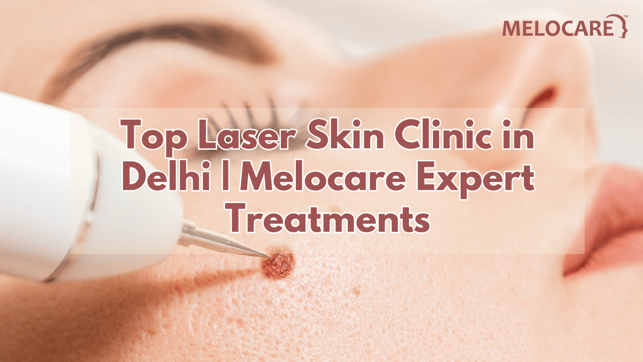 Laser Skin Clinic in Delhi