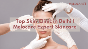 Skin Clinic in Delhi