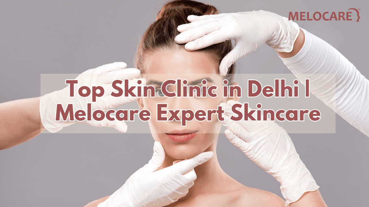 Skin Clinic in Delhi